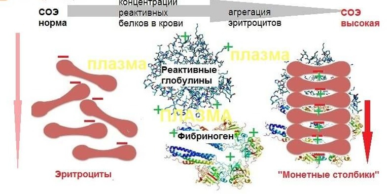 СОЭ – норма в крови у женщин, причины повышения